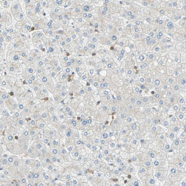 FMNL1 Antibody in Immunohistochemistry (IHC)