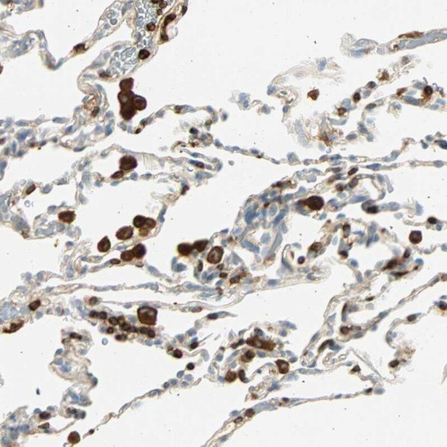 FMNL1 Antibody in Immunohistochemistry (IHC)