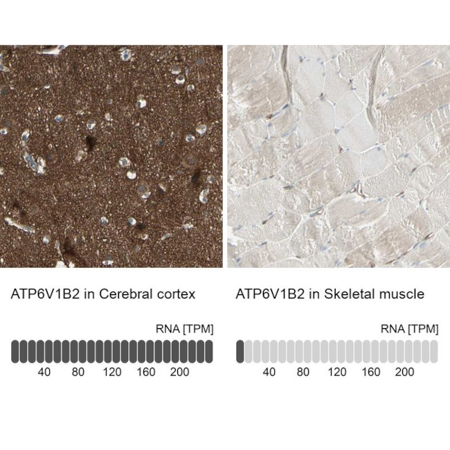 ATP6V1B2 Antibody in Immunohistochemistry (IHC)