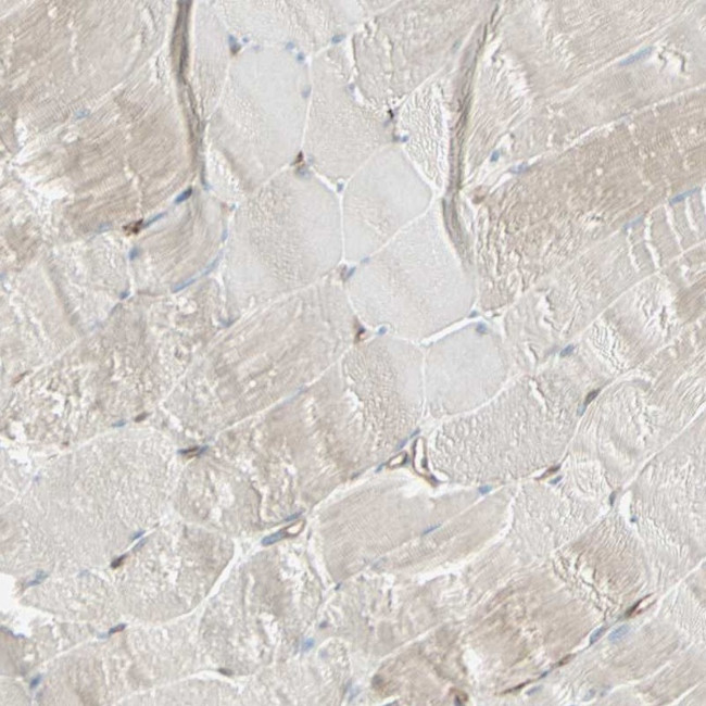 ATP6V1B2 Antibody in Immunohistochemistry (IHC)