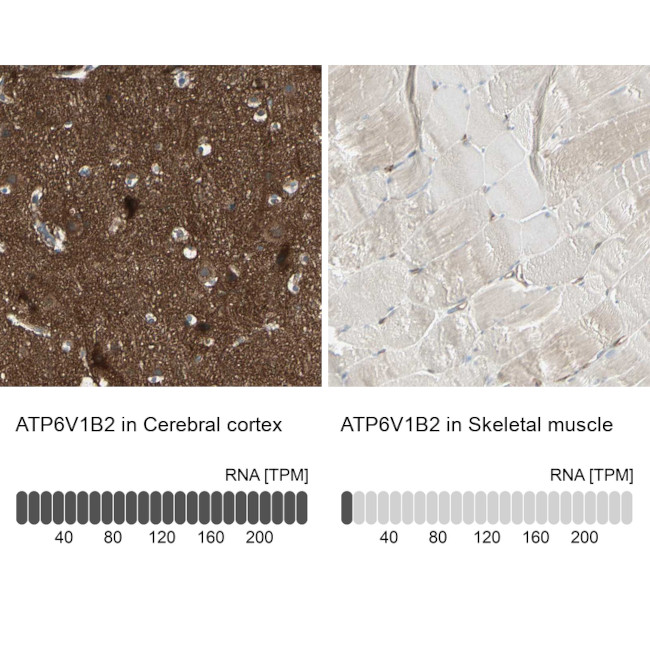 ATP6V1B2 Antibody