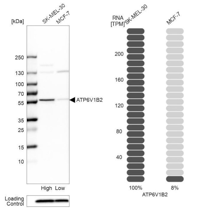 ATP6V1B2 Antibody