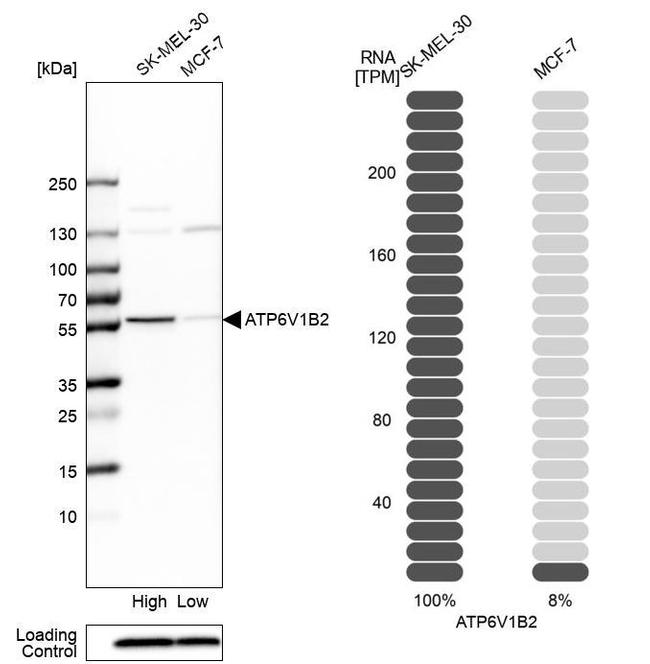 ATP6V1B2 Antibody in Western Blot (WB)