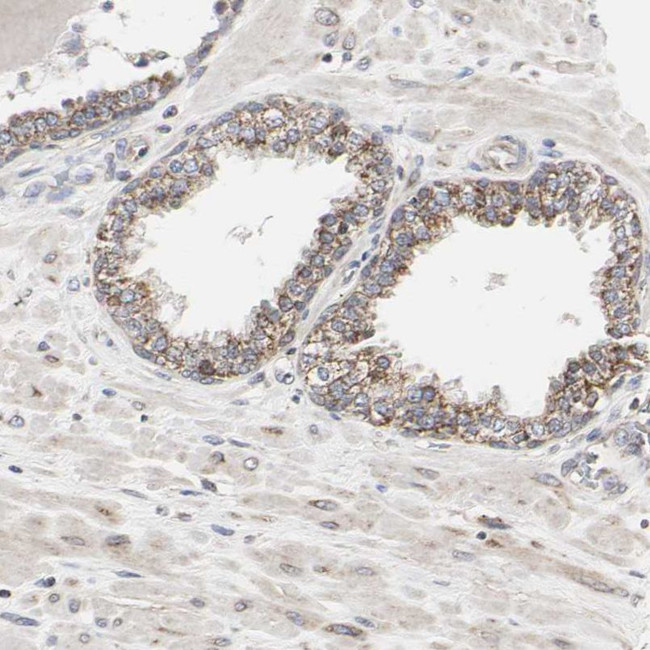 TSKU Antibody in Immunohistochemistry (IHC)