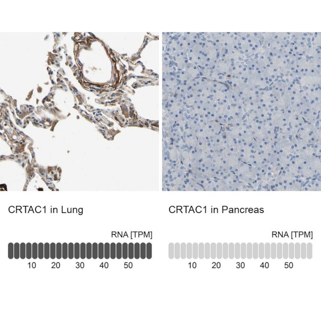 CRTAC1 Antibody in Immunohistochemistry (IHC)