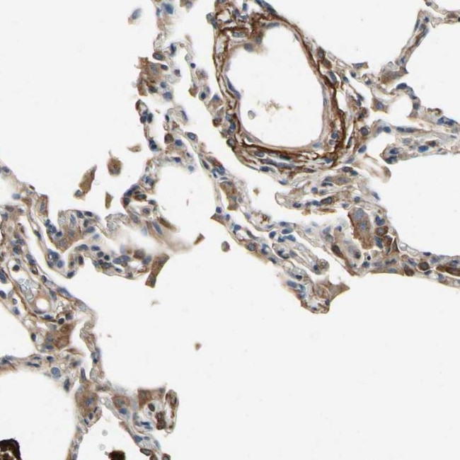 CRTAC1 Antibody in Immunohistochemistry (IHC)