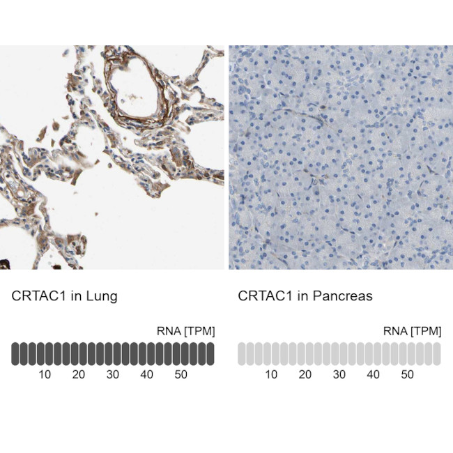 CRTAC1 Antibody