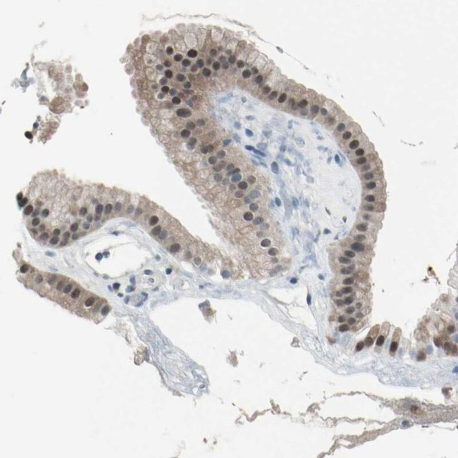 PSMA2 Antibody in Immunohistochemistry (IHC)