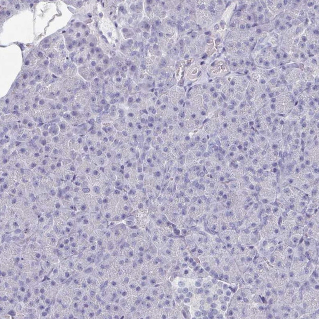 OMG Antibody in Immunohistochemistry (IHC)