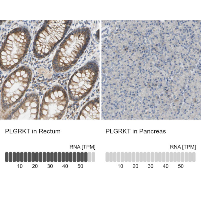 PLGRKT Antibody in Immunohistochemistry (IHC)