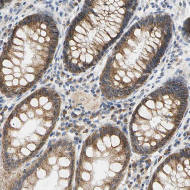 PLGRKT Antibody in Immunohistochemistry (IHC)