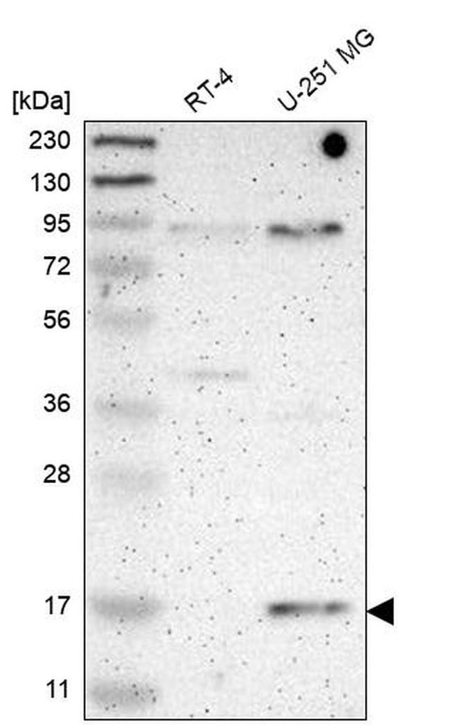 PLGRKT Antibody in Western Blot (WB)