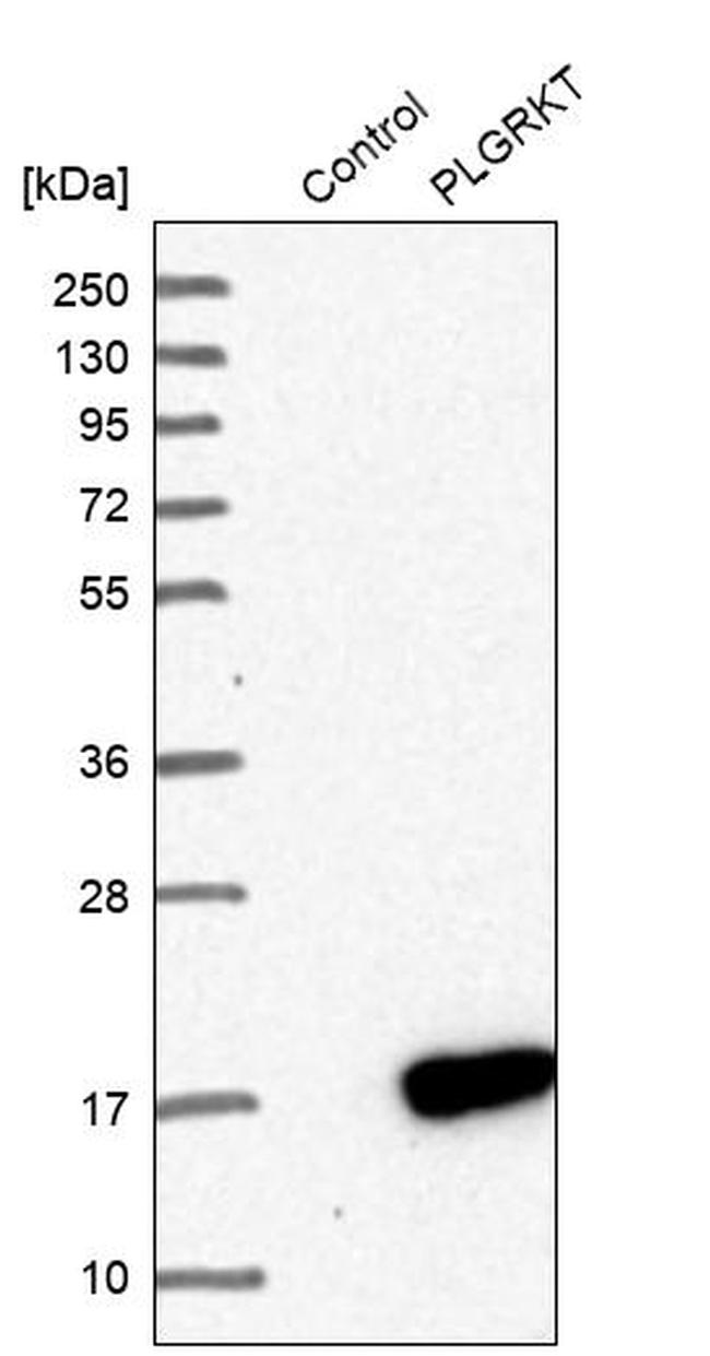 PLGRKT Antibody in Western Blot (WB)