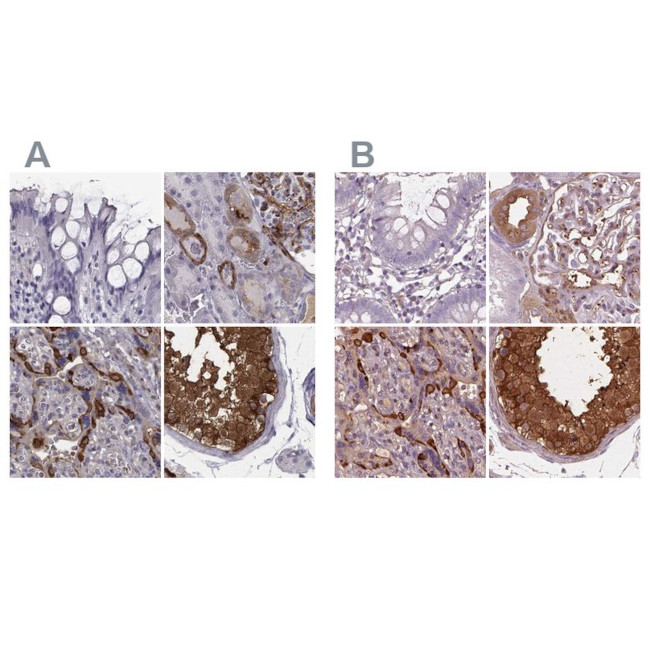 ISYNA1 Antibody in Immunohistochemistry (IHC)