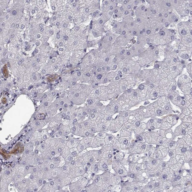 ISYNA1 Antibody in Immunohistochemistry (IHC)