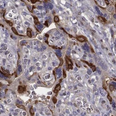 ISYNA1 Antibody in Immunohistochemistry (IHC)