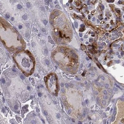 ISYNA1 Antibody in Immunohistochemistry (IHC)