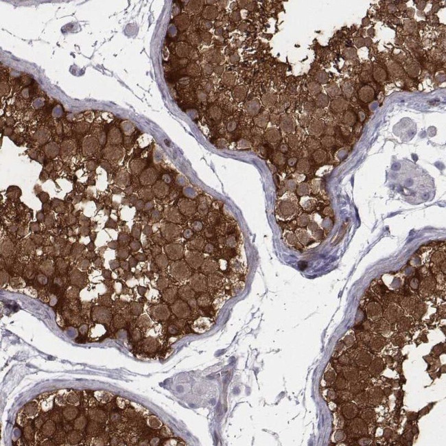 ISYNA1 Antibody in Immunohistochemistry (IHC)