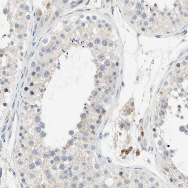 GAS6 Antibody in Immunohistochemistry (IHC)