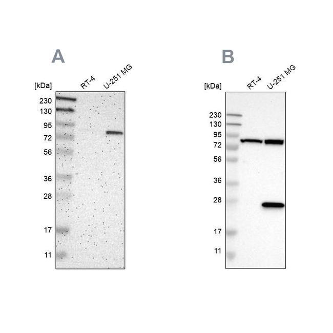 ALDH18A1 Antibody in Western Blot (WB)