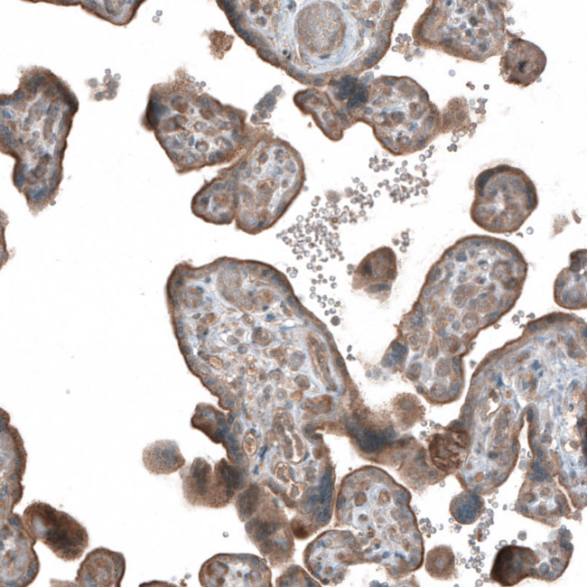 HMGCR Antibody in Immunohistochemistry (IHC)