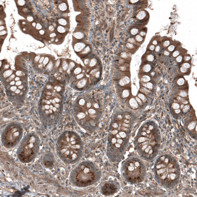 HMGCR Antibody in Immunohistochemistry (IHC)