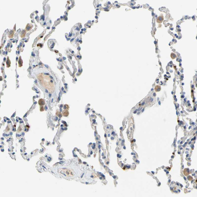 PPBP Antibody in Immunohistochemistry (IHC)