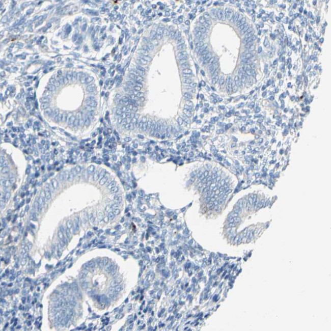 PPBP Antibody in Immunohistochemistry (IHC)