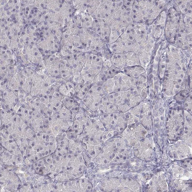 EAF2 Antibody in Immunohistochemistry (IHC)