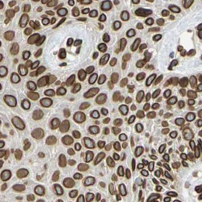 UNC84A Antibody in Immunohistochemistry (IHC)