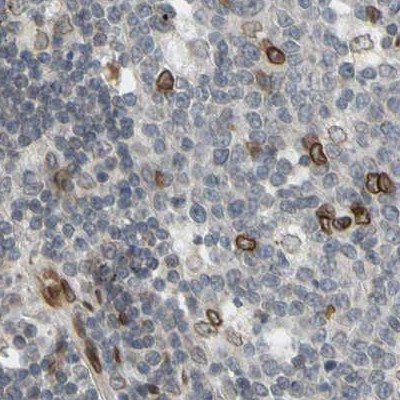 UNC84A Antibody in Immunohistochemistry (IHC)