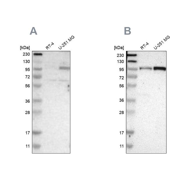 UNC84A Antibody in Western Blot (WB)