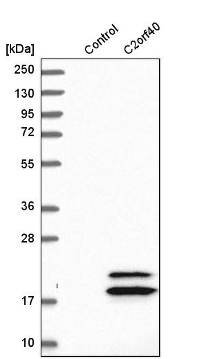 ECRG4 Antibody in Western Blot (WB)