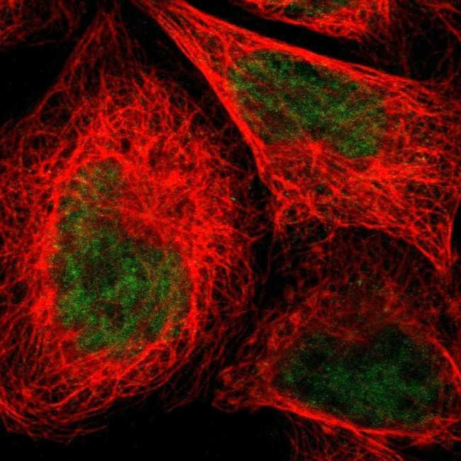 NMI Antibody in Immunocytochemistry (ICC/IF)