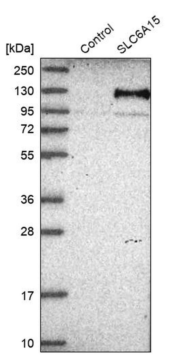 SLC6A15 Antibody in Western Blot (WB)