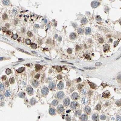 POGZ Antibody in Immunohistochemistry (IHC)