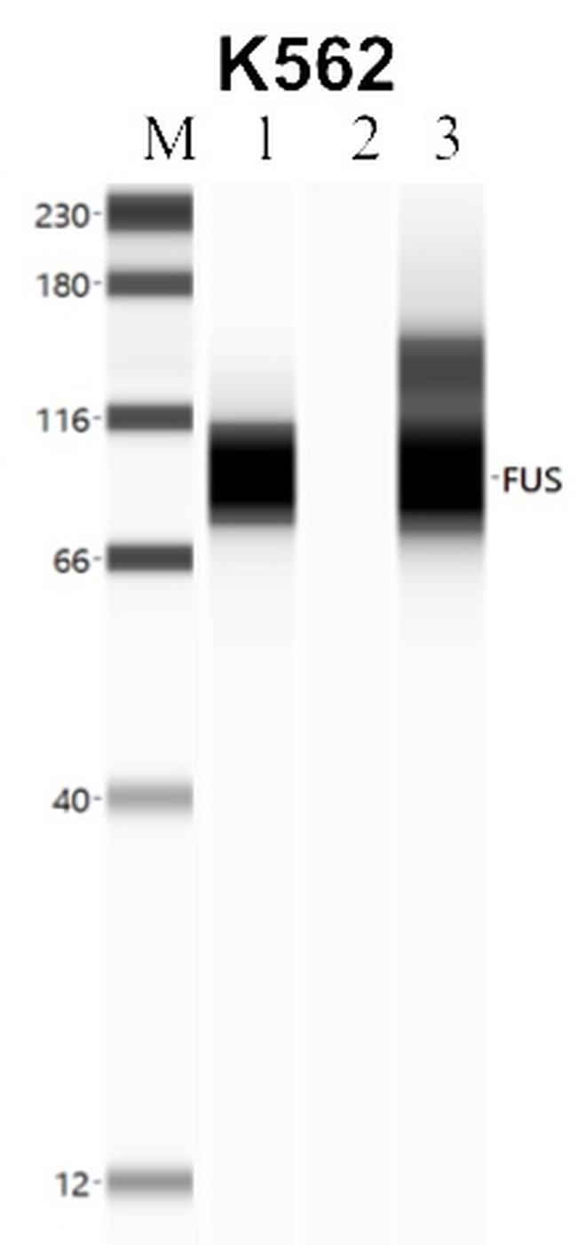 FUS Antibody in RNA Immunoprecipitation (RIP)