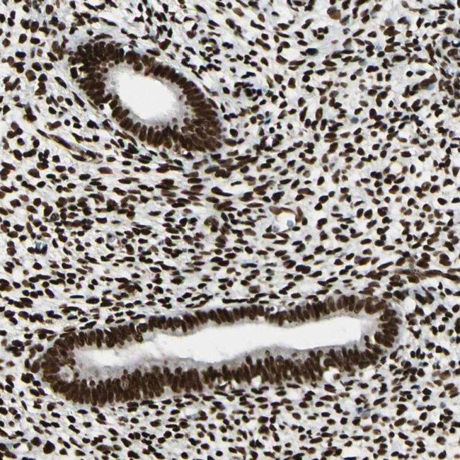 FUS Antibody in Immunohistochemistry (IHC)