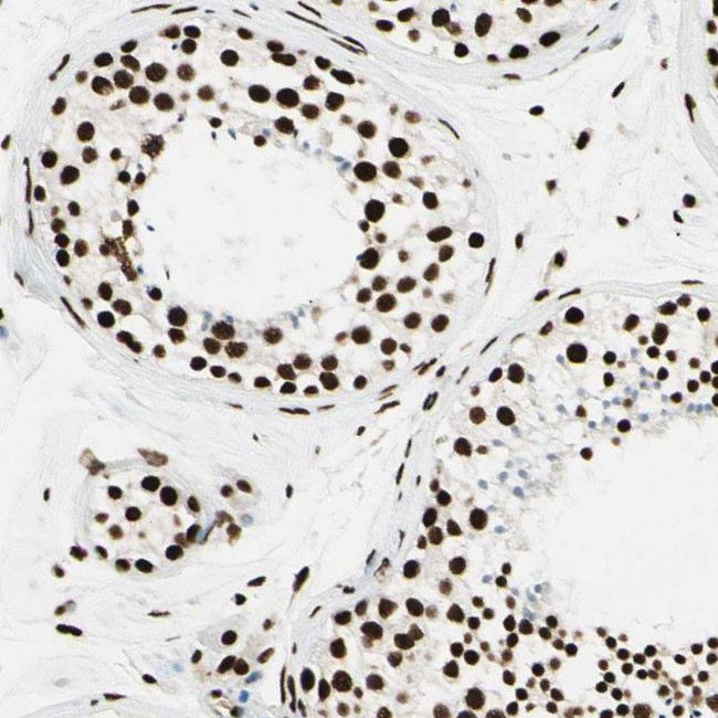 FUS Antibody in Immunohistochemistry (IHC)