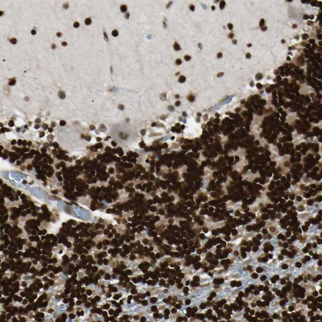 FUS Antibody in Immunohistochemistry (IHC)