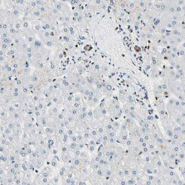 FUS Antibody in Immunohistochemistry (IHC)