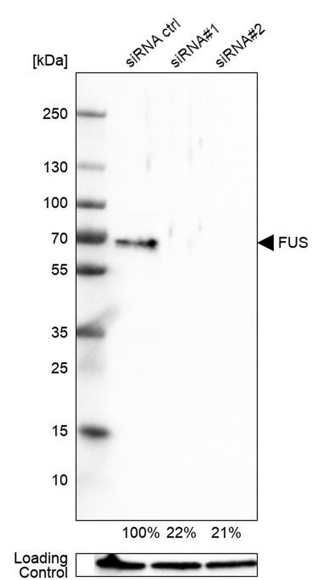 FUS Antibody in Western Blot (WB)