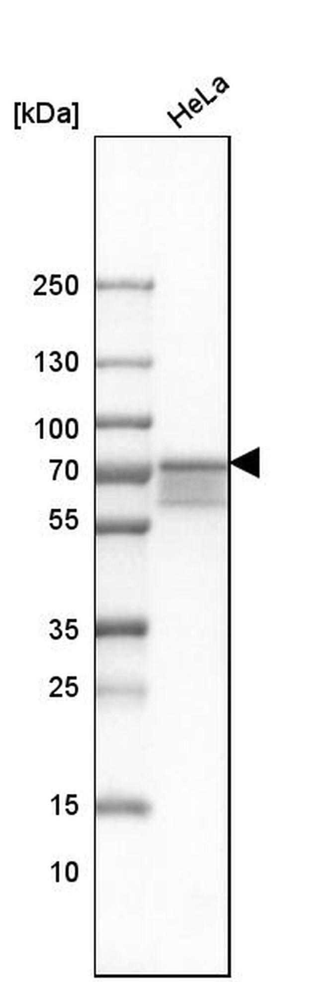 FUS Antibody in Western Blot (WB)