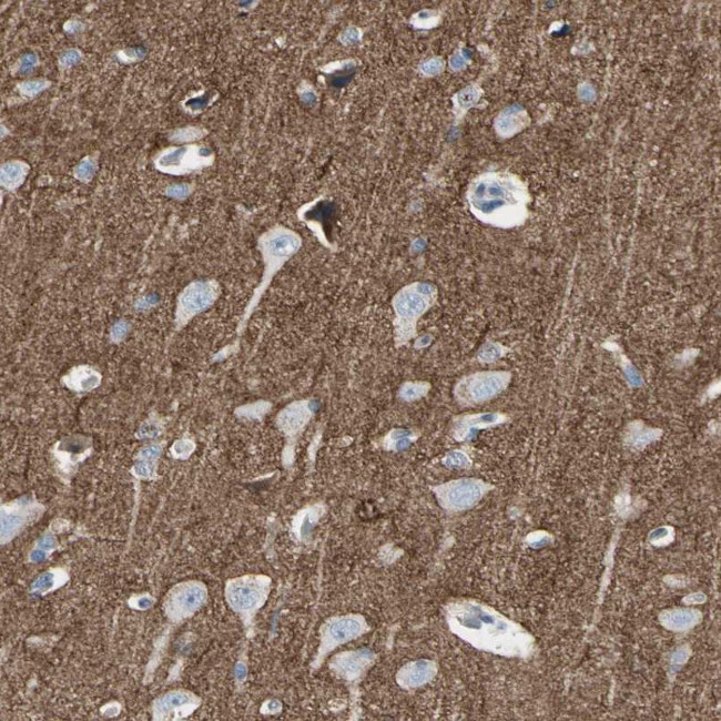 Neurofascin Antibody in Immunohistochemistry (IHC)