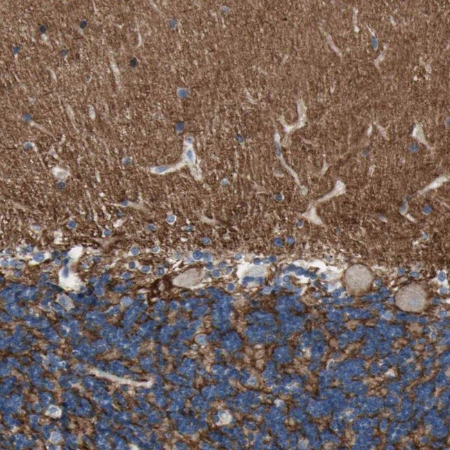 Neurofascin Antibody in Immunohistochemistry (IHC)