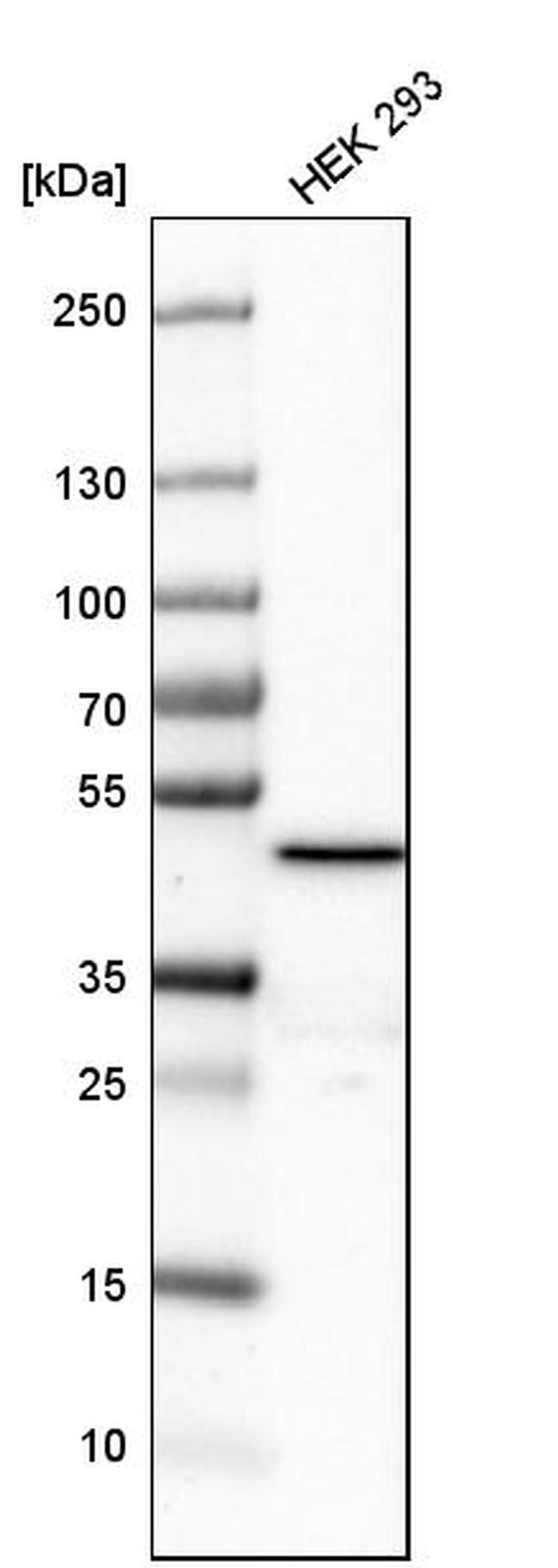 FDFT1 Antibody in Western Blot (WB)