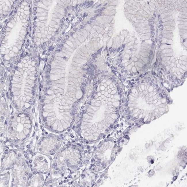 ADAM7 Antibody in Immunohistochemistry (IHC)