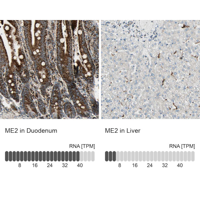 ME2 Antibody in Immunohistochemistry (IHC)