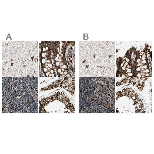 ME2 Antibody in Immunohistochemistry (IHC)