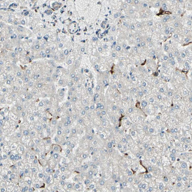 ME2 Antibody in Immunohistochemistry (IHC)